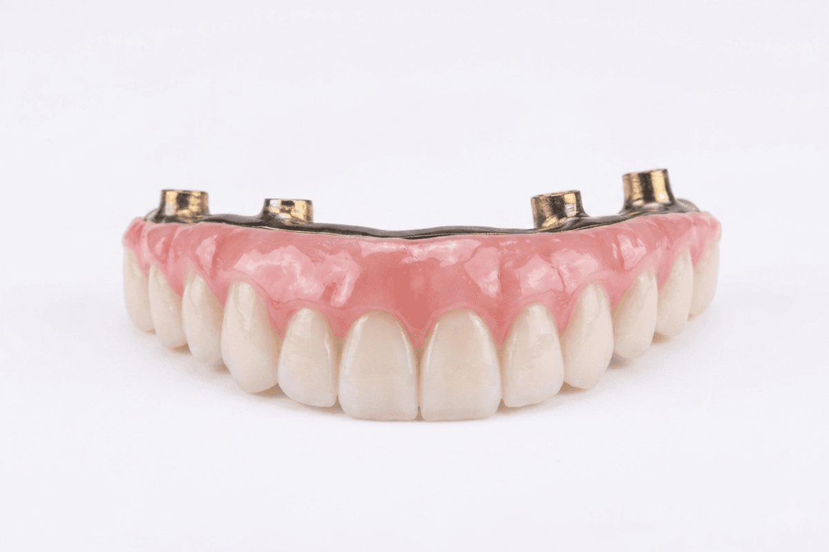 Hybrid Prosthesis
