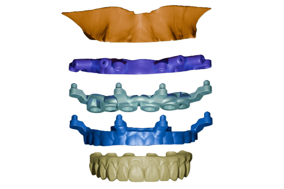 Stackable Guide